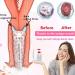 Vaginal Cleaning Syringe | Reusable Manual Pressure Cleaner Kit with 3 Nozzles - 600ml Capacity for Personal Hygiene - Buy Online on GoSupps.com