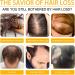 Biotin Hair Growth Serum - Traitement avanc pour des cheveux plus pais plus forts et plus sains r duit la perte de cheveux (2pcs) - Buy Online on GoSupps.com