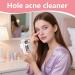 Facial Suction Pore Cleaner - Pore Cleaner White Spot Vacuum Extractor 3 Levels of Suction Use At Home Or In The Shower Women And Teens - Buy Online on GoSupps.com