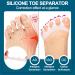 Silicone Toe Separators for Bunions & Hammertoes - Restore Toes & Correct Big Toe Shape | International Shipping - Buy Online on GoSupps.com
