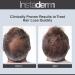 Hair Stimulating Growth Serum - Extra Strength DHT Blocker for Thicker Fuller Hair | Follicle Restoration for Men & Women - Shop Now - Buy Online on GoSupps.com