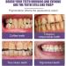 Purple Teeth Whitening Powder - Deep Clean & Brighten for Fresh Breath | 3PC - Results in 3 Days! - Buy Online on GoSupps.com