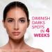 Cicatricure Face Peel - Antimanchas Exfoliating Serum with AHA & PHA | Dark Spot Reduction & Skin Glow | 0.9 oz - International Shipping Available - Buy Online on GoSupps.com