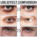 Anti Wrinkles Eye Serum Under Eye Serum For Dark Circle Eye Cream Anti Aging Nicotinamide Eye Creams For Dark Circle Hydrating Under Eye Cream - Buy Online on GoSupps.com