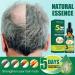 dijiusidy Ginger Hair Growth Oil Prevent Baldness Good-absorption Fast Growing 30MLSerum Nourish Tools Female - Buy Online on GoSupps.com