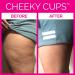 Cheeky Cups Cellulite Suction Cup Set - Anti Cellulite Massage Kit for Skin Firming and Lymphatic Drainage - 2 Silicone Cups for Legs, Buttocks, Thighs - Buy Online on GoSupps.com