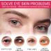 Retinol Eye Stick Retinol Eye Cream for Dark Circles and Puffy Eyes Eye Cream for Wrinkles Under Eye Cream Anti Aging Eye Bags Remover Eye Care Products Instant Wrinkle Remover Firming Eye Cream - Buy Online on GoSupps.com