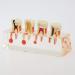 Buy Dental 4-Stage Endodontic Treatment Clear Model - Ideal for Study & Teaching | International Shipping Available - Buy Online on GoSupps.com