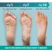 L'AMOUR Exfoliating Foot Peeling Masks - Removes Dead Skin & Calluses | Baby Feet Peel - 5 Pairs - Buy Online on GoSupps.com
