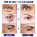 Shop Glozie Anti-Wrinkle Eye Serum & Instant Lift Cream - Effective Anti-Aging Solutions - Buy Online on GoSupps.com