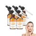 VKaoess Advanced Retinol Serum for the Face PlantBased Peptides & Vitamin E Smoothes Wrinkles & Fine Lines Addresses AgeDarkening Noncomedogenic for Sensitive Skin 5 Bottles