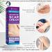 Kelinul Scar Cream - Silicone Gel for C-Section Stretch Marks & Acne Scars - 1.7 oz - Buy Online on GoSupps.com