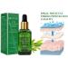 Tea Tree Acne Treatment Serum 17ml - Clear Severe Acne Breakouts and Repair Skin | Pimple Remover - 0.6 Fl Oz - Buy Online on GoSupps.com