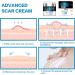 Scar Removal Cream - Repair & Moisturize Old/New Scars, for Male/Female, Surgery/Scald/Burns - 1.85 FL OZ - Buy Online on GoSupps.com
