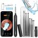 Ear Cleaner with Camera 1080P HD Ear Wax Removal Tool Camera Ear Wax Removal Kit with Camera Otoscope with 6 LED Light Ear Camera Wax Removal Ear Cleaners for Adults with 15 Ear Pick