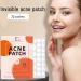 Fast-Acting Hydrocolloid Acne Patches | 72 Invisible Stickers for All Acne Types | Covers Pimples Hides Spots & Removes Oil - Shop Now - Buy Online on GoSupps.com
