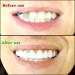 Realistic Upper and Lower Veneer Cosmetic Teeth Set for Confident Smile - 4 PCS Fake Teeth for Men and Women with Comfortable Fit - Buy Online on GoSupps.com