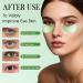 60 Pi ces Patch Yeux Anti Cernes Masque pour les Yeux Aloe Vera Yeux claircir Les Cernes Nourrit et lisse le contour des yeux R duit les Cernes Sous les Yeux - Buy Online on GoSupps.com