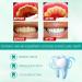 Yuyuando 60ml Teethaid Mouthwash - Tooth Whitening Mousse Dental Aid Oral Care Replacement (3 Pieces) - Buy Online on GoSupps.com