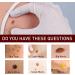 WZDYN 2023 New Wipe Off and Remover | Extreme Skin Wipe Off & Remover | Fast Easy to Remove | for Face Armpit Flesh Neck (5pcs) - Buy Online on GoSupps.com