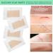 Silicone Scar Removal Sheets - C-Section, Surgery, Burns, Acne, Stretch Marks - 4 Sheets - Buy Online on GoSupps.com
