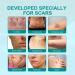 DUBUSH Scarremove Advanced Scar Spray - For Acne, Surgical Scars & Stretch Marks - Gentle Skin Care - 2pcs - Buy Online on GoSupps.com