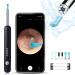 Ear Wax Removal - R1 Earwax Remover Tool with 1080P HD Camera 6 LED Lights - Wireless Ear Cleaner Built-in WiFi - Earwax Removal Kit Compatible with iPhone Android