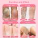 2 Pairs Foot Peel Mask for Soft Baby-Soft Feet | Exfoliating & Moisturizing Callus Remover Treatment Socks with Plant Formula | Rose Scented - Buy Online on GoSupps.com