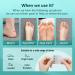 ROLLII Bunion & Blister Pads Toe & Foot Corn Protector, Hydrocolloid Bandages for Bunion Relief, Sole & Heel Cushions Waterproof, Thin Design 10PCS - Buy Online on GoSupps.com
