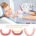 DIY Denture Kit - Top & Bottom Fake Teeth with Comfort Fit for Everyday Use Natural-Looking Emergency Replacement Solution - Buy Online on GoSupps.com