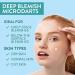 Buy Microdart Blemish Patches - 27 Fast Acting Zit Patches for Cystic Acne - Infused with Hyaluronic Acid & Tea Tree - International Shipping Available - Buy Online on GoSupps.com