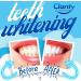 Sensitivity-Free Teeth Whitening Strips- 14 Treatments, 28 Whitening Strips - Non-Slip Grip Teeth Whitener by Dentists for Safe White Smile - Buy Online on GoSupps.com