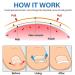 Ingrown Toenail Treatment Kit - 50Pcs No Glue Corrector Patch & Tools - Protect and Repair Ingrown Nails - Buy Online on GoSupps.com