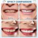 2 Paires Proth se Dentaire Cosm tique Dentier Sourire Parfait Instantan es Fausse Dent Naturel A Poser Dentier Sourire Parfait Sup rieurs Et Inf rieurs Pour Homme Femme - Buy Online on GoSupps.com