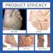  JIAOY Urea cream 60% 60% urea cream for cracked heels and dry skin repairing cream for cracked heels - Moisturizing cream for hands and feet - Skin softening cream - Buy Online on GoSupps.com