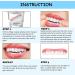 6 Sets Veneers Snap in Teeth Kit | Permanent Denture Filling for Missing Teeth | Temp Tooth Replacement - 6 Pairs - Buy Online on GoSupps.com