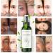 Centella Asiatica Face Toner Spray - Anti-Aging & Acne Solution | 3.4 fl oz - Shop Now for International Shipping - Buy Online on GoSupps.com