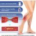 Plantar Fasciitis Massager Slippers - Acupressure Reflex Zone Foot Massage Shoes for Relief | Byriver Brown (Size 35-37) - Perfect Relaxation Gift for Mom & Dad - Buy Online on GoSupps.com