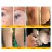Hacaus Bee Venom Comprehensive Cream 2025 New Skincare Treatment Bee Venom Skin Cream Visibly reduces skin blemishes Natural Skin Moisturizer for Face and Body - Buy Online on GoSupps.com