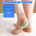 PetGlimmer 4 Pairs Moisturizing Heel Socks Gel Heel Socks Reusable Toeless Spa Socks for Women Gel Heel Socks Soft Breathable Ventilate Heel Open Toe for Dry Hard Chapped Skin - Buy Online on GoSupps.com