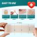 Silicone Scar Sheets Roll - 4M Medical Silicone Care Tape for Hypertrophic, C-Section, Acne, Keloid, Surgery Scars & Stretch Marks - Buy Online on GoSupps.com