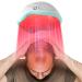 Laser Hair Growth Cap Red Light Therapy Helmet for Hair Regrowth FDA Cleared Hair Loss Treatment for Men and Women with Thinning Hair Rechargeable Hair Growth Product