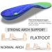 Orthotic Insole for Plantar Fasciitis, Overpronation, Flat Feet Arch Support for Men and Women, Heel Pain Relief Blue, Size 11-11.5 (30-30.5CM) - Buy Online on GoSupps.com