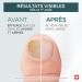PODERM Tea Tree R parateur Ongles 6 ml S rum 4en1 | Am liore l apparence des ongles ab m s jaunis et ternes Uniformise l paisseur R sultats visibles d s le 1er jour 100% naturel Swiss Made - Buy Online on GoSupps.com