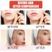 Original Hydrocolloid Acne Patches - 108 Count Spot Stickers for Zits & Blemishes | International Shipping - Buy Online on GoSupps.com