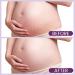 AOAO Stretch Mark Butter for Pregnancy | Body Balm for Women with Shea Butter & Vitamin E | Paraben-Free Formula for Scars & Stretch Mark Repair | Belly Butter for Pregnant Women (Shea Butter_1) - Buy Online on GoSupps.com