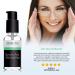 Yeouth Glycolic Acid 30% Gel Peel - Exfoliating Facial Peel | 2 fl oz (60 ml) - Buy Online on GoSupps.com