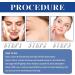 10% Niacinamide Serum + 1% Zinc Serum for Blemish-Prone Skin - Moisturizing and Oil-Control Face Serum | Brightening Formula to Minimize Pores and Redness - 1PCS - Buy Online on GoSupps.com