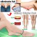 3pcs Adjustable Carnelian Magnetic Bracelet for Lymph Drainage and Slimming - Buy Online on GoSupps.com