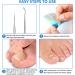 SANNIX Ingrown Toenail Tool Set with 100 Pieces Correction Patches Curved Double Toenail File & Ingrown Nail Cleaner for Men and Women - Buy Online on GoSupps.com